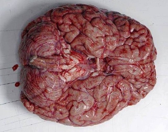 علت تاخورده و چروک بودن مغز کشف شد