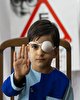 ۲۶هزار کودک ۳ تا ۶ ساله چهارمحال وبختیاری در طرح غربالگری تنبلی چشم معاینه شدند