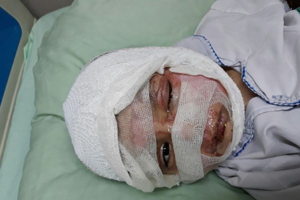 «نرگس» و «شیما» در آتش سوختند+عکس «نرگس» و «شیما» در آتش سوختند+عکس