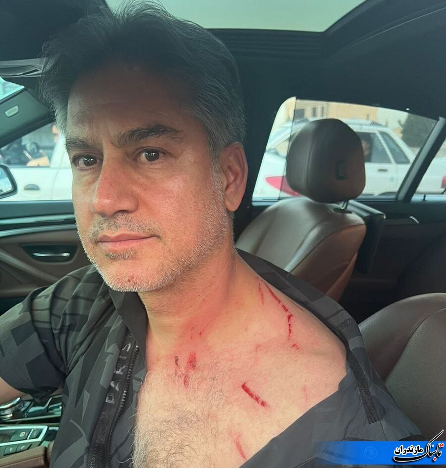 حمله سارقان موتورسوار به سرمربی سابق تیم فوتبال نساجی