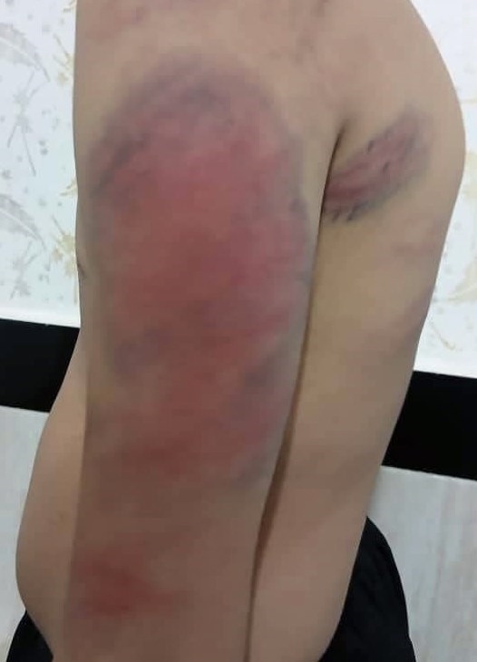 ضرب و شتم شدید دانش آموزان سنندجی به دلیل گم شدن شارژر تلفن همراه معلم/ ورود آموزش و پرورش کردستان به موضوع ضرب و شتم شدید دانش آموزان سنندجی به دلیل گم شدن شارژر تلفن همراه معلم/ ورود آموزش و پرورش کردستان به موضوع